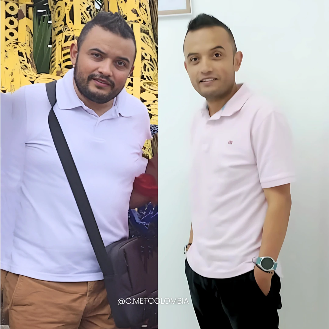 Antes y Después 5