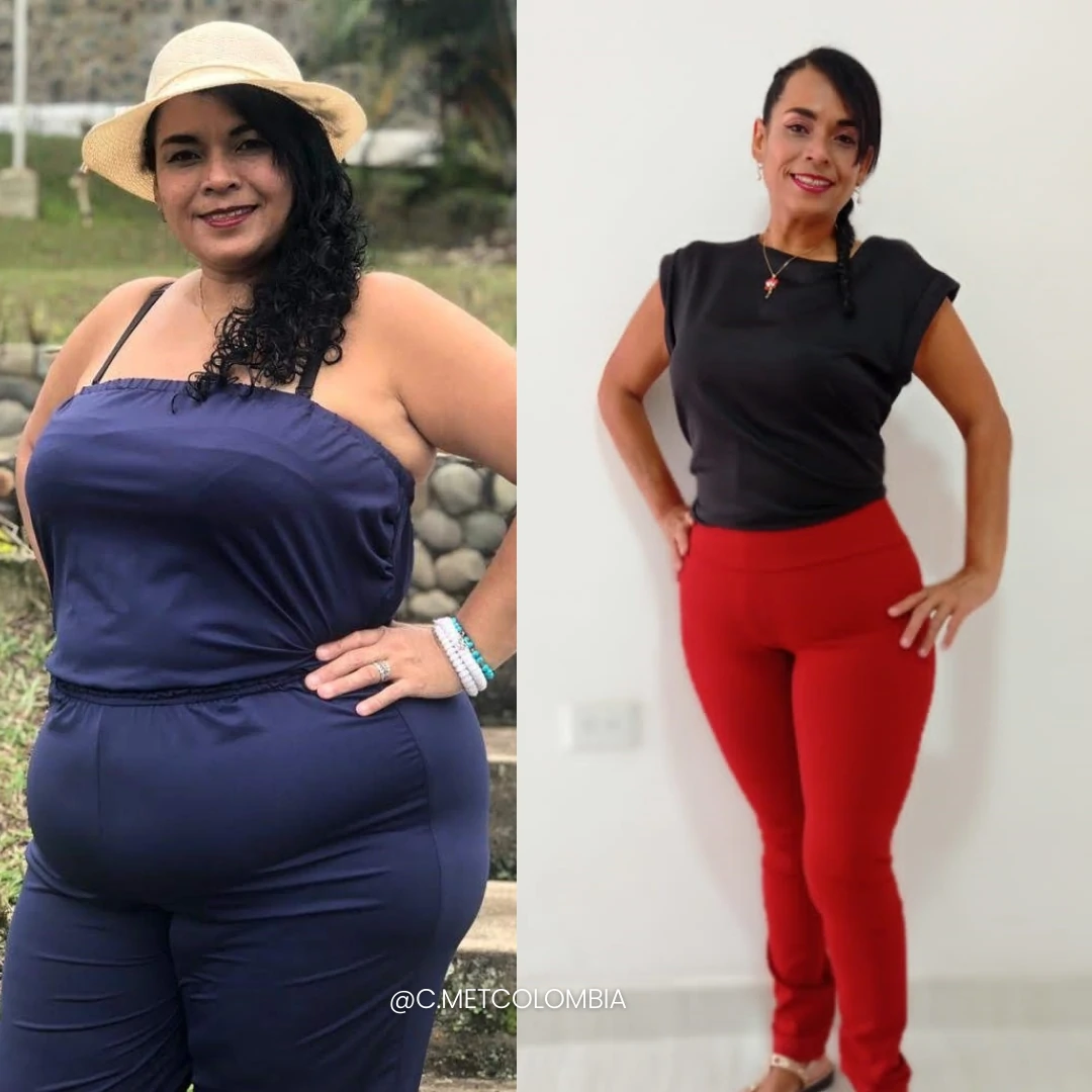 Antes y Después 2