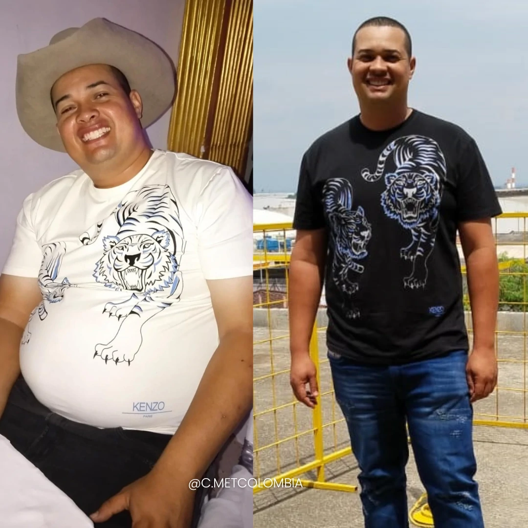 Antes y Después 3