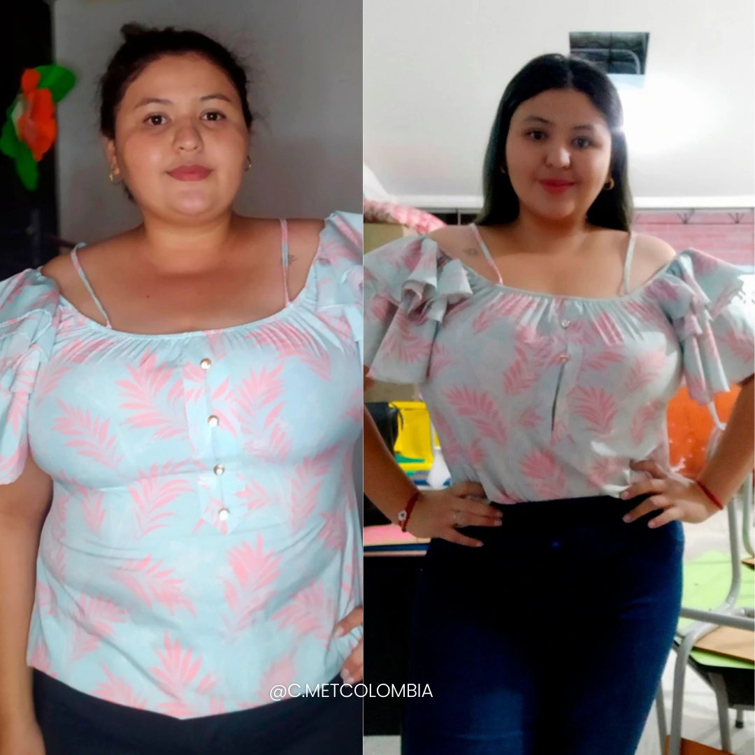 Antes y Después 6