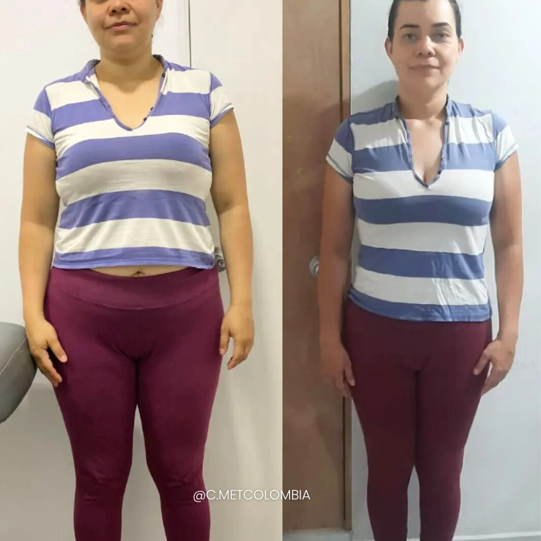Antes y Después 7