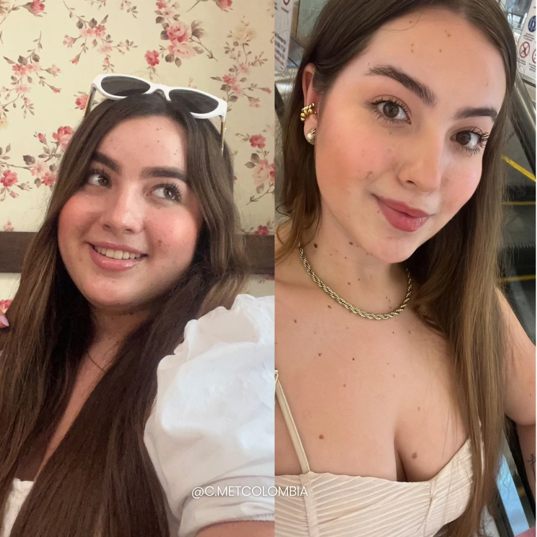 Antes y Después 8