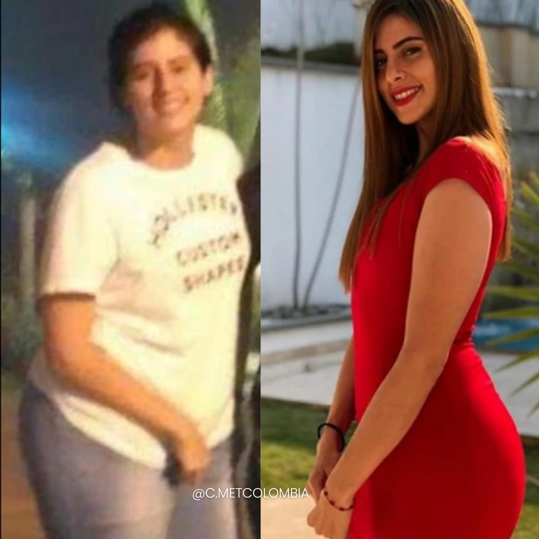 Antes y Después 1